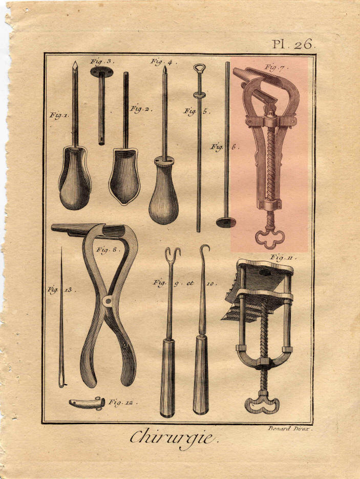 diderot d'alembert speculum vaginale