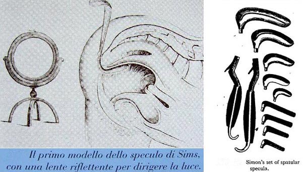 Vaginal speculum Sims Simon catalog