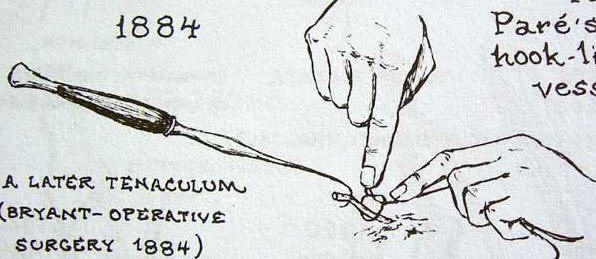 Immagine tenaculum Medical Instruments